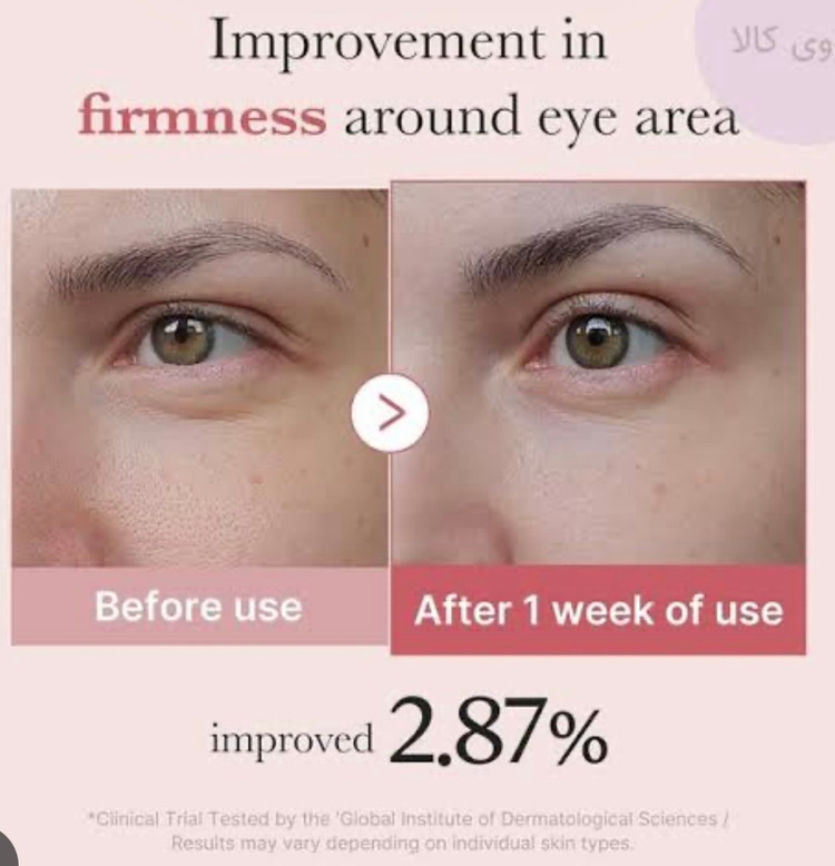 کرم دور چشم مدیکیوب Deep Lifting Peptide Eye Cream